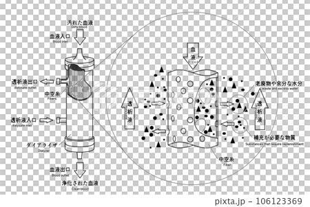 Image illustration of dialyzer 106123369