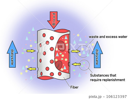 ダイアライザのイメージイラスト 106123397
