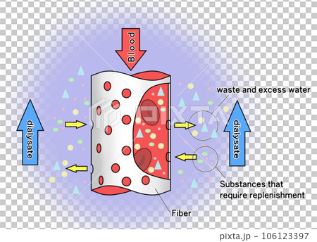 ダイアライザのイメージイラスト 106123397