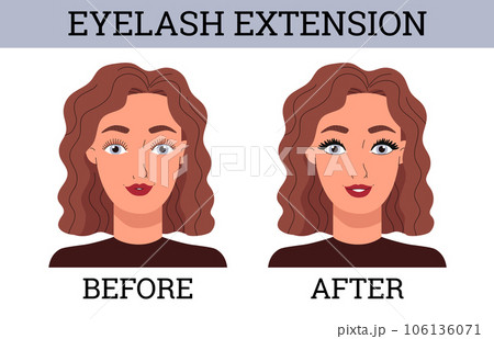 Eyelash extension before and after infographic banner flat vector illustration. 106136071