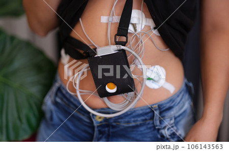 Woman with Holter monitor for daily monitoring of electrocardiogram and blood pressure. 106143563