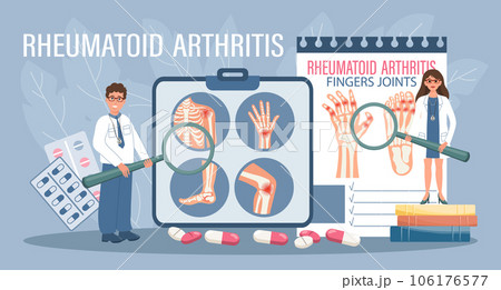 Rheumatoid arthritis for landing page. Arthritis treatment. Doctors with magnifiers show diseases of the human skeletal system. Template, banner, vector 106176577