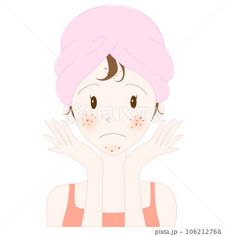 Young woman face with acne skin problem Young woman face with acne skin problem 106212768