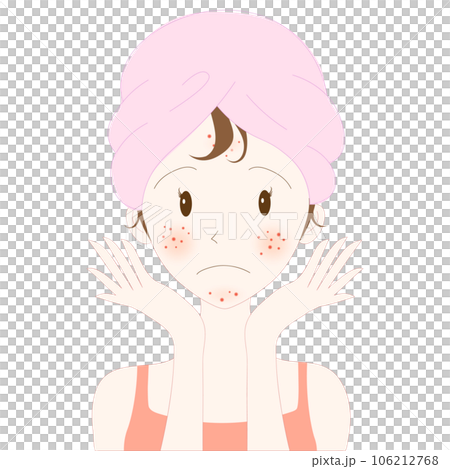 Young woman face with acne skin problem Young woman face with acne skin problem 106212768