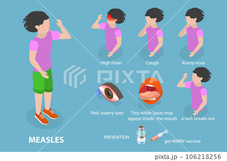 3D Isometric Flat Vector Conceptual Illustration of Measles 3D Isometric Flat Vector Conceptual Illustration of Measles 106218256