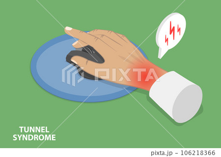3D Isometric Flat Vector Conceptual Illustration of Tunnel Syndrome 106218366