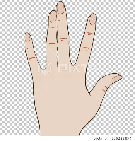 あかぎれのイラスト あかぎれのイラスト 106228874