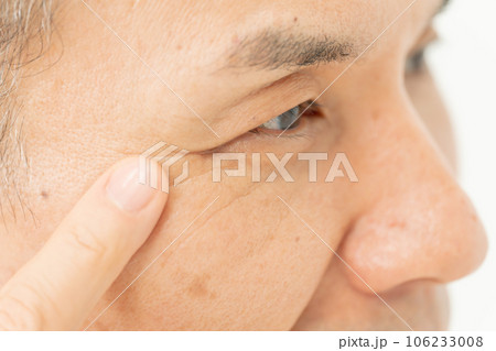目元 男性 目元 男性 106233008