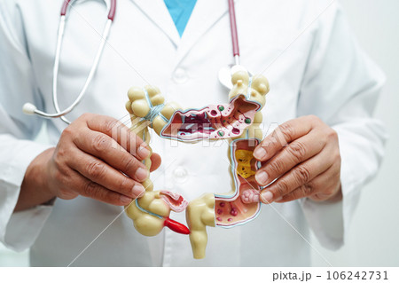 Intestine, doctor holding anatomy model for study diagnosis and treatment in hospital. Intestine, doctor holding anatomy model for study diagnosis and treatment in hospital. 106242731