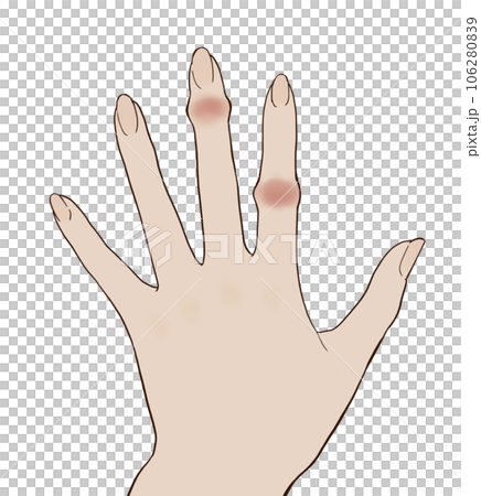 赫伯登節點和布沙爾節點 赫伯登節點和布沙爾節點 106280839