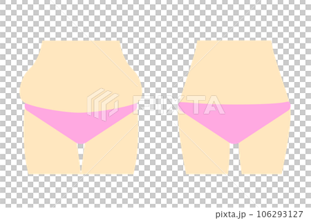 Before and after dieting women 106293127