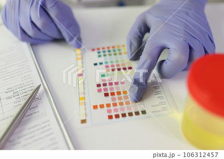 On the table strips of dough pH urine, close-up 106312457