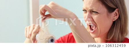 A young woman is shocked by hair loss on a comb A young woman is shocked by hair loss on a comb 106312459