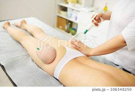 Vacuum massage of the buttocks. Hijama, cellulite removal from problem areas in a modern massage parlor. Vacuum massage of the buttocks. Hijama, cellulite removal from problem areas in a modern massage parlor. 106348250