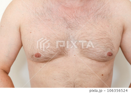 Close up of hairy man's chest, male nipples, light thin hair on breast unrecognisable young guy. White skin with birthmarks. Overweight, not slim Close up of hairy man's chest, male nipples, light thin hair on breast unrecognisable young guy. White skin with birthmarks. Overweight, not slim 106356524