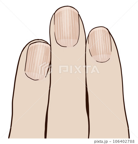 爪の縦線 106402788