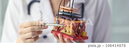 Female dermatologist holding artificial model of human skin with hair 106414878