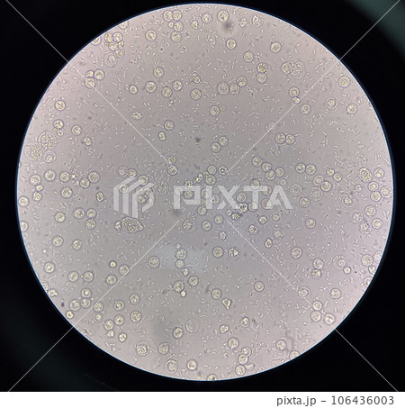 Fresh bacteria cell in urine sample. 106436003