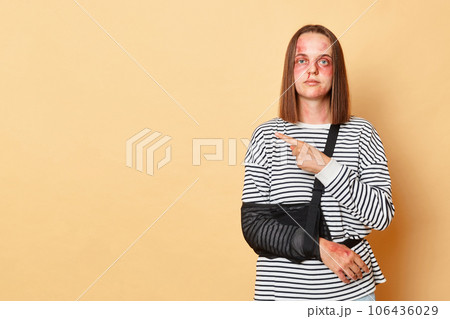 Sad unhappy woman in striped shirt with bandage and bruised skin standing isolated over beige background pointing away at copy space for advertisement or promotion al text Sad unhappy woman in striped shirt with bandage and bruised skin standing isolated over beige background pointing away at copy space for advertisement or promotion al text 106436029