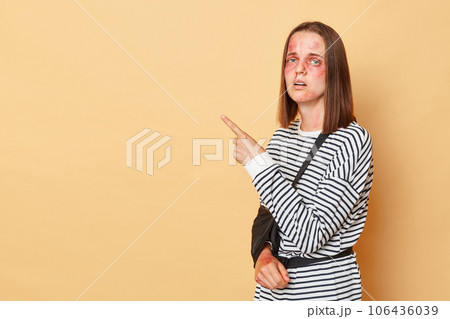Upset unhappy woman in striped shirt with bandage and bruised skin standing isolated over beige background indicating at empty area copy space. 106436039