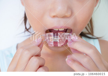 子ども用歯科矯正具 106460015