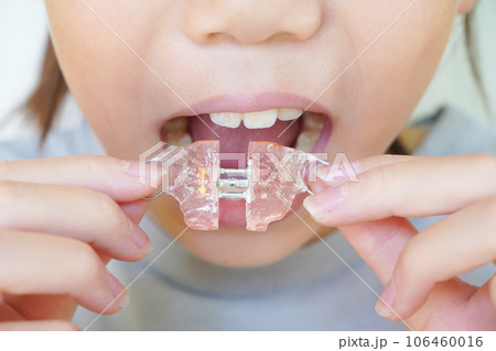 子ども用歯科矯正具 106460016
