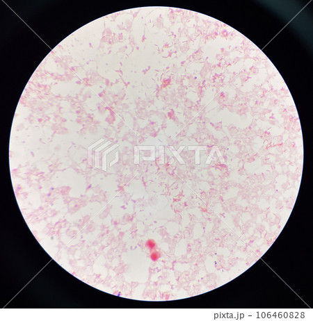 Red cell gram negative bacilli in hemo culture. 106460828