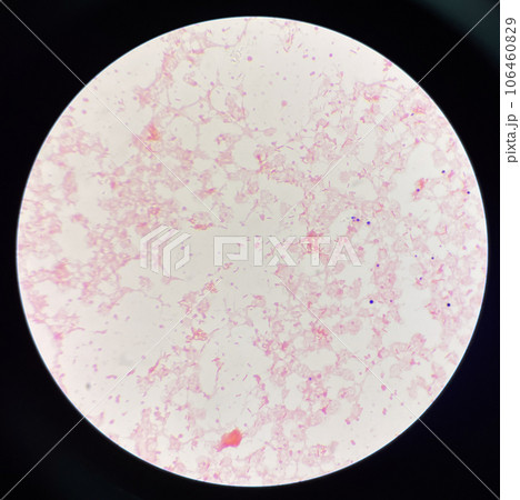 Red cell gram negative bacilli in hemo culture. Red cell gram negative bacilli in hemo culture. 106460829