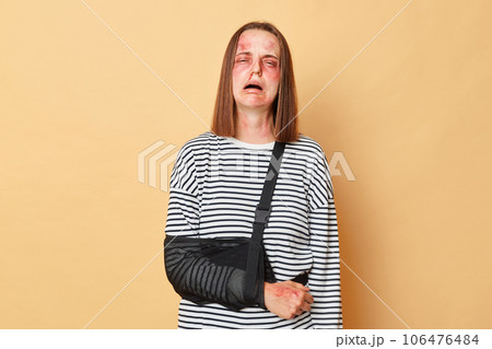Despair sad unhappy woman with scratches and bruises on face with bandage wearing striped shirt standing isolated over beige background cryinh after get traumas after husband's abuse. 106476484