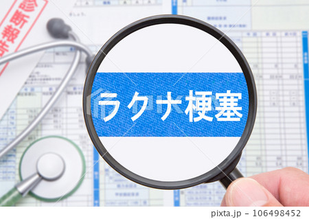 ラクナ梗塞　医療イメージ 106498452