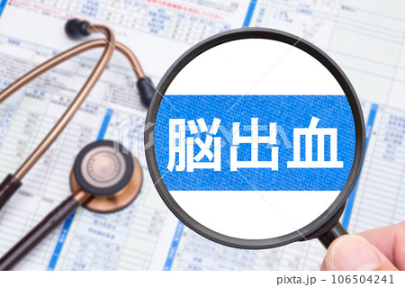 脳出血 医療イメージ 脳出血 医療イメージ 106504241