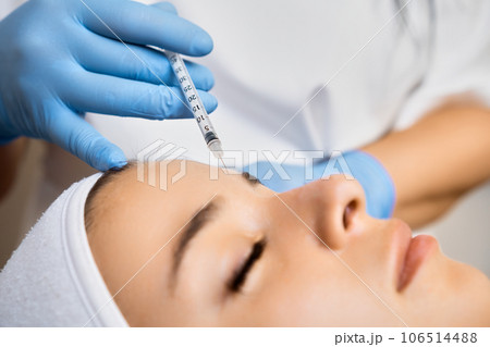 Young woman getting a rejuvenating facial injection in the clinic. Professional application of botox and hyaluronic acid.  106514488