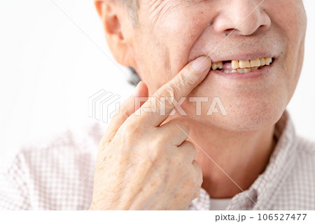 シニア 男性 歯抜け デンタル シニア 男性 歯抜け デンタル 106527477