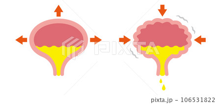 膀胱のイラスト 膀胱のイラスト 106531822