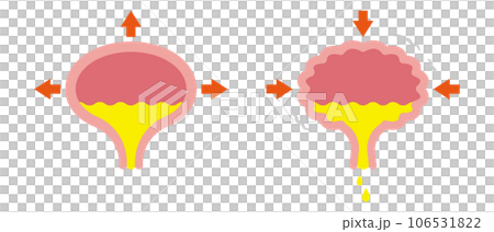膀胱のイラスト 膀胱のイラスト 106531822