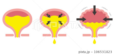 膀胱のイラスト 106531823
