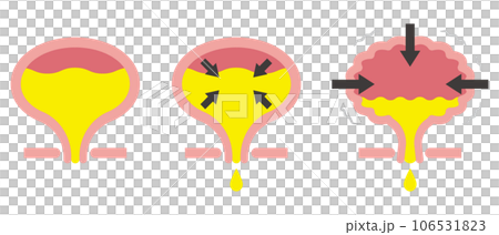 膀胱のイラスト 106531823