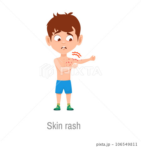 Child with skin rash disease. Isolated vector sick boy with itchy red spots on skin. Eczema, dermatitis dermatology sickness symptoms. Infection or allergic reaction Child with skin rash disease. Isolated vector sick boy with itchy red spots on skin. Eczema, dermatitis dermatology sickness symptoms. Infection or allergic reaction 106549811