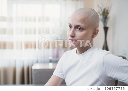 Portrait of a young hairless woman with a diagnosis of oncology, looks sadly to the side 106567736
