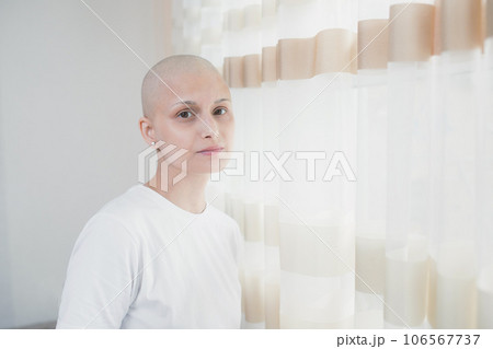 A young woman in a white t-shirt with oncology who has lost her hair after chemotherapy stands by the window, looks at the camera 106567737