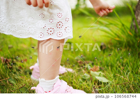 cute asian little girl has skin rash and allergy from mosquito bite and sucking blood at legs while playing on green grass field outdoor cute asian little girl has skin rash and allergy from mosquito bite and sucking blood at legs while playing on green grass field outdoor 106568744