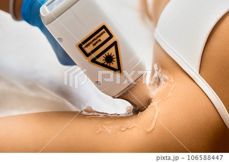 Beautician uses epilation laser treatment to woman armpit, close up. Beautician uses epilation laser treatment to woman armpit, close up. 106588447
