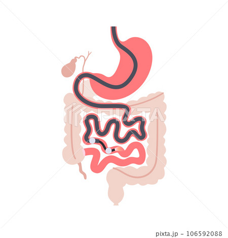 Double balloon enteroscopy 106592088