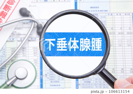 下垂体腺腫（かすいたいせんしゅ） 106613154
