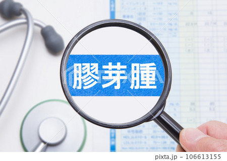 膠芽腫(こうがしゅ) 膠芽腫(こうがしゅ) 106613155