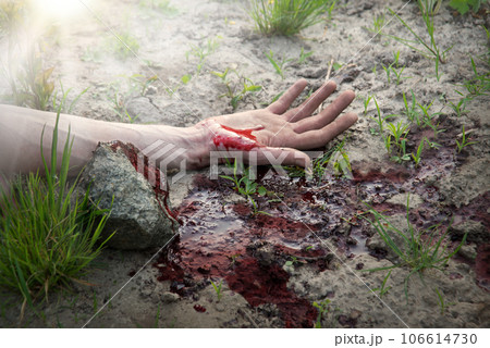 Bloodied hand lies on the ground 106614730