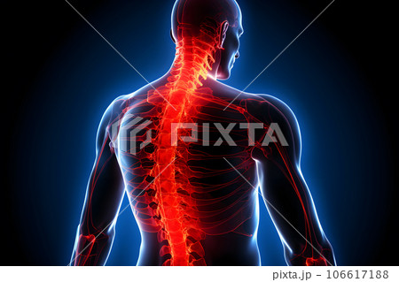 Illustration of a painful spine. Neural network...のイラスト素材 [106617188 ...