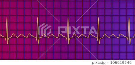 ECG in atrial flutter, 3D illustration ECG in atrial flutter, 3D illustration 106619546