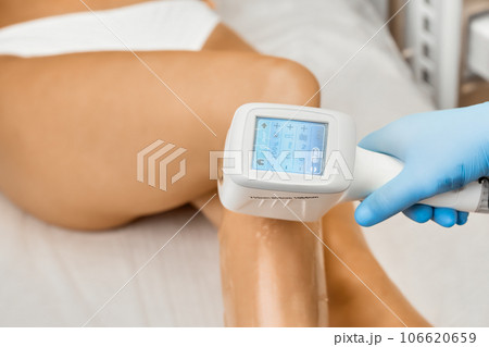 Close up a screen of laser epilator in woman hands in protective gloves on the leg of client.  106620659