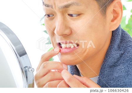 口腔トラブルを気にする男性 106630426